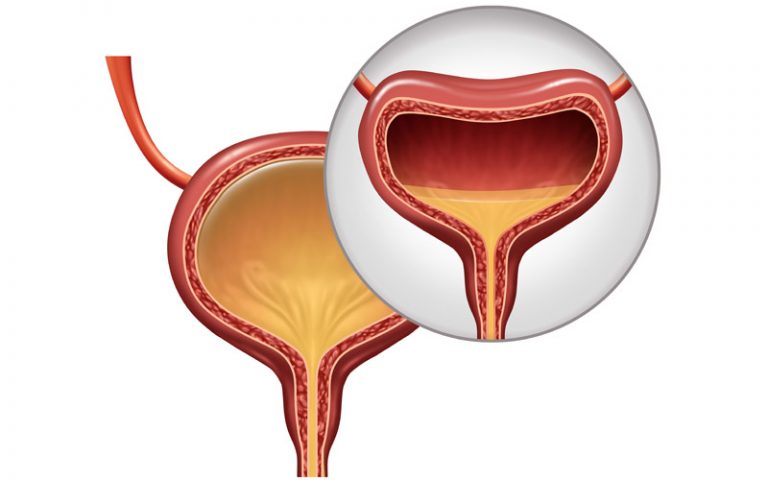 Overactive Bladder general health Urology Clinics of North Texas